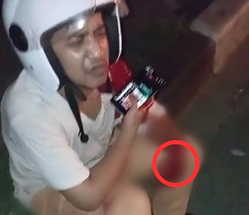 Ngeri! Pria Ini Jadi Korban Begal Sadis di Medan, Tangan Nyaris Putus Dibacok