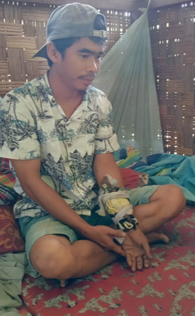 Tangan Salamudin Remuk Dipukul Tajak, Pelaku Belum Ditahan