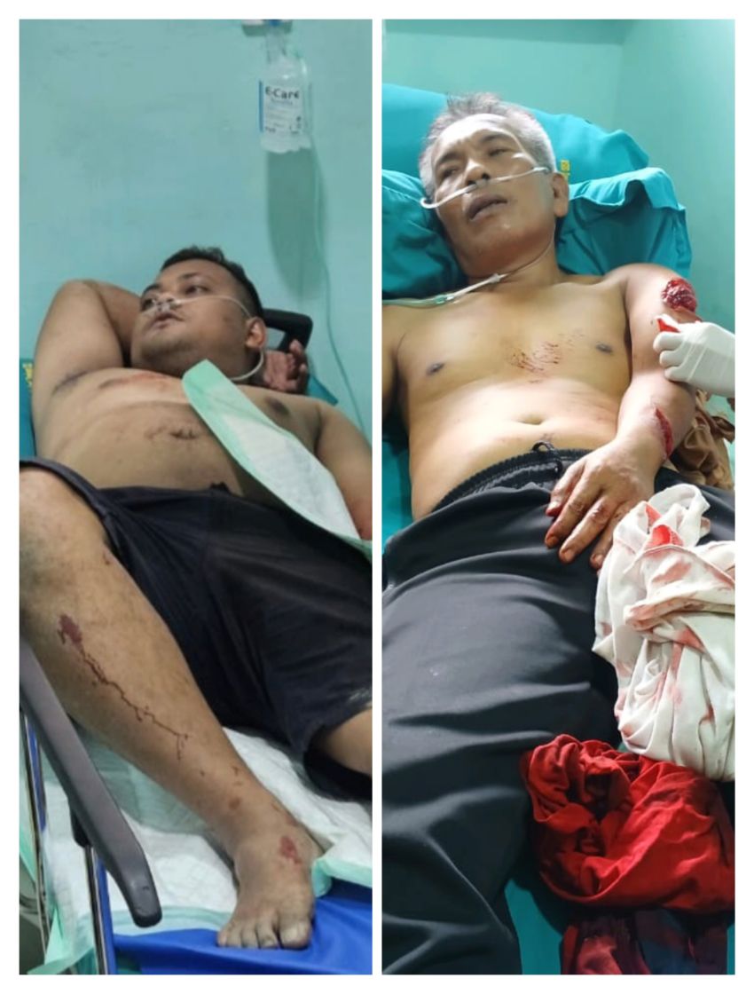 Kondisi Terkini Jaksa Jhon Wesli Sinaga Tangan Amputasi Cacat Seumur Hidup
