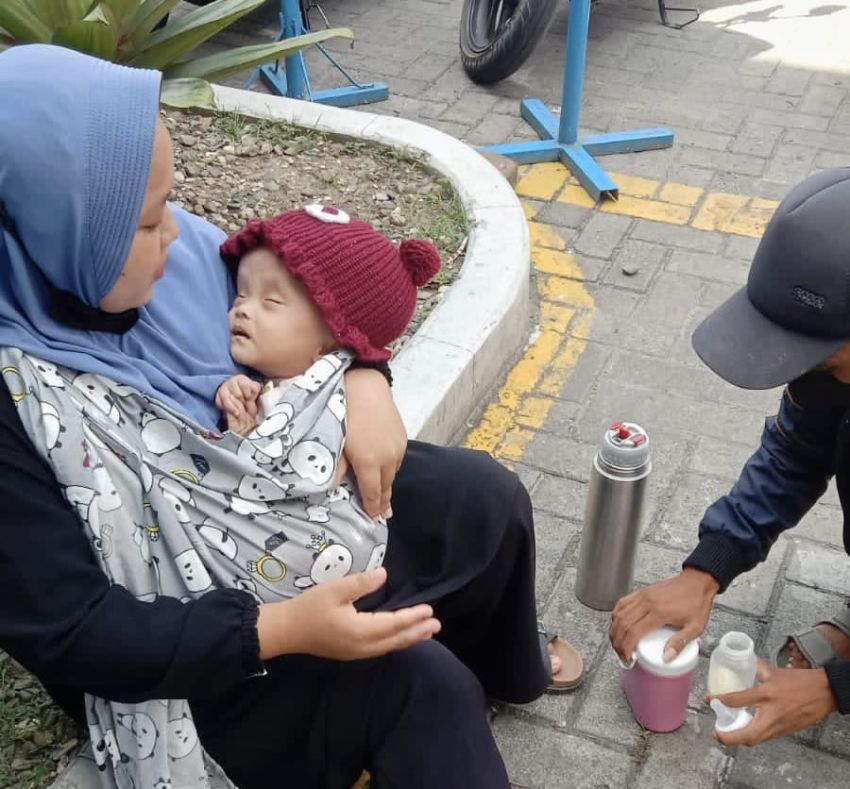 Gercep!! Wabup Rianto dan BRI Kisaran Bantu Balita Hidrosefalus