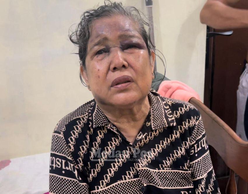 Sadis, Wanita Lansia di Medan Dirampok Saat Mau Salat Subuh, Wajah Dibenturkan-Kepala Dipukul Berulang Kali