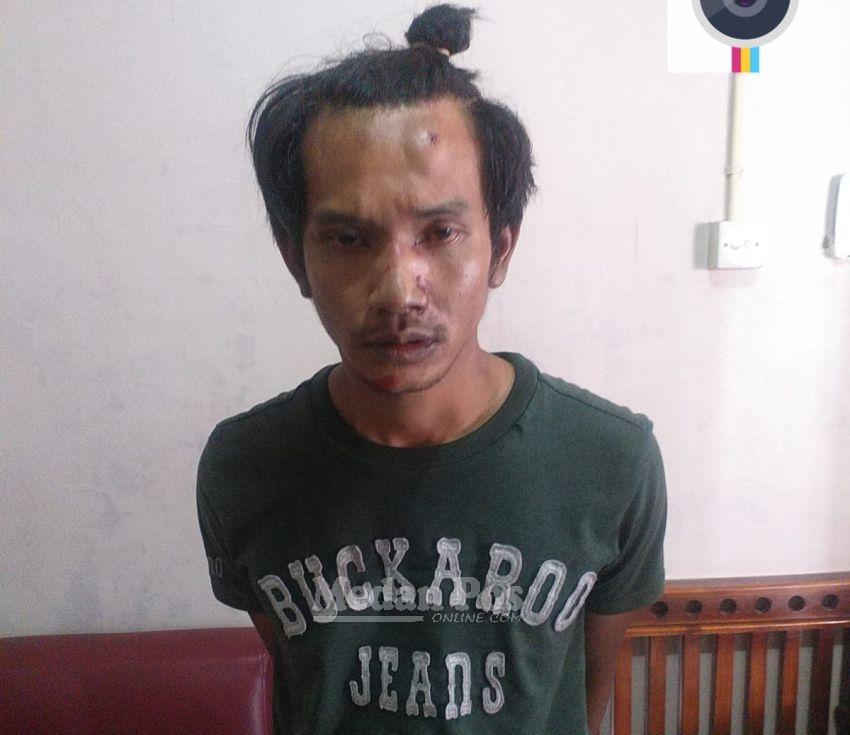 Tampang Penjambret Hp di Jalan Halat Berdarah-darah Dimassa