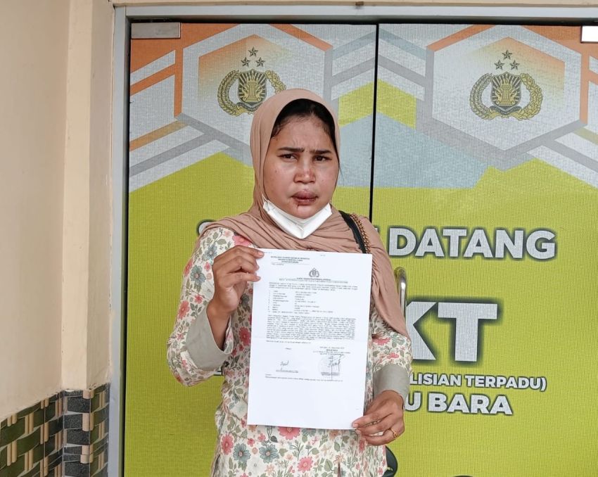 Seorang IRT Warga Desa Aras Babak Belur Dihajar Pencuri