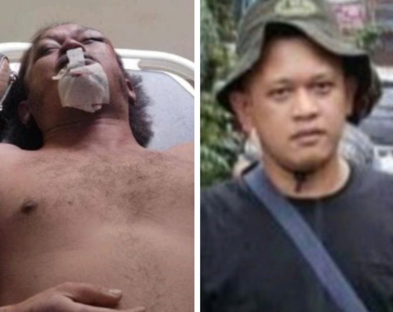 Kata LBH Medan Ada 6 Kejanggalan Kematian Wartawan Nico Saragih