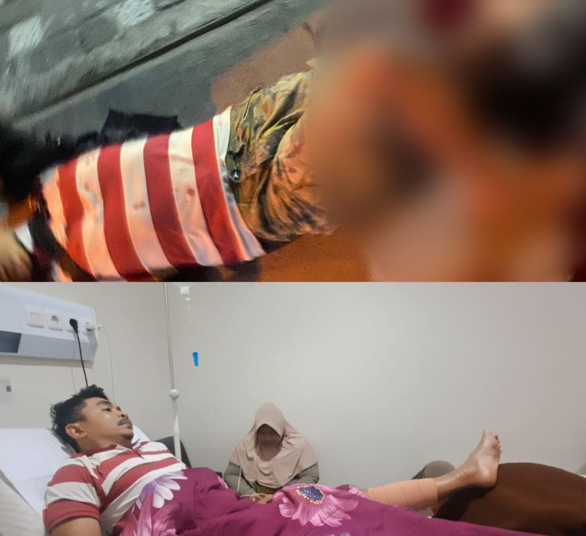 Tukang Giling Bakso Diserang Gerombolan Geng Motor, Kaki Berlumuran Darah Dibacok